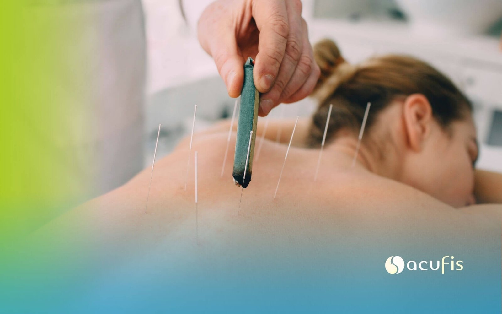 Imagen combinar fisioterapia y acupuntura